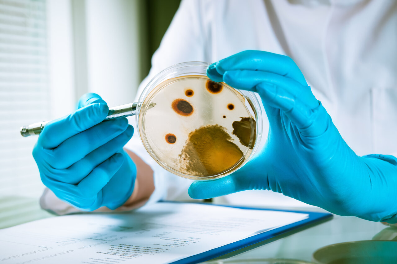 Hände die sich eine Petrischale ansehen mit Bakterien und in einem Labor
